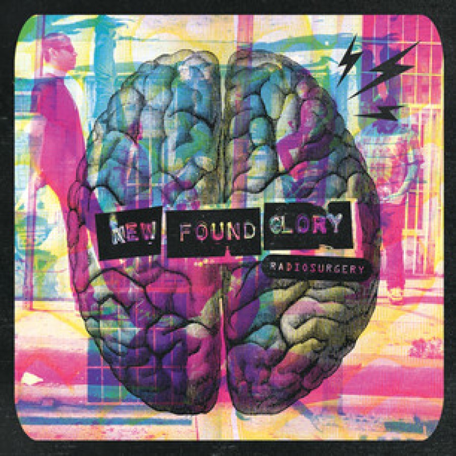 New Found Glory – Radiosurgery / CD